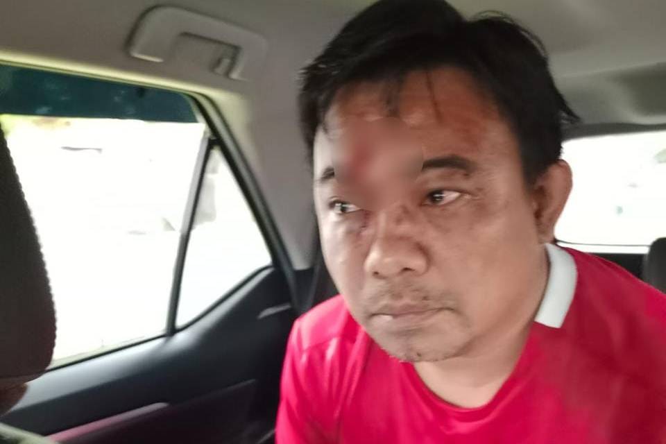Ketua Umum Dewan Pengurus Pusat Komite Nasional Pemuda Indonesia (KNPI) Haris Pertama dikeroyok sekelompok orang di Cikini, Jakarta Pusat pada Senin (21/2/2022) pukul 14.10 WIB. (dok. Pribadi/Haris Pertama)