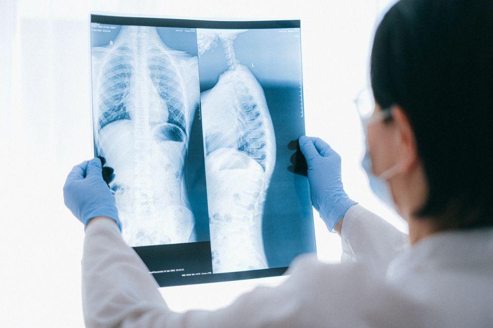 Hipertensi Pulmonal: Penyebab, Jenis, Gejala, Komplikasi, Pengobatan