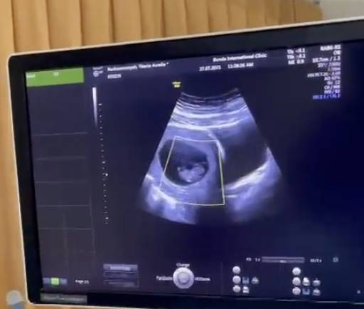 Potret Aurel Hermansyah lahiran (instagram.com/aurelie.hermansyah)