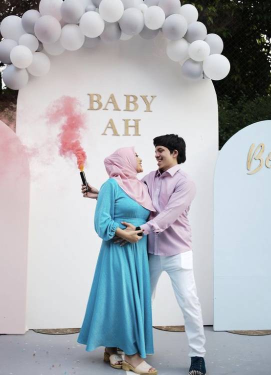 Potret Aurel Hermansyah lahiran (instagram.com/aurelie.hermansyah)