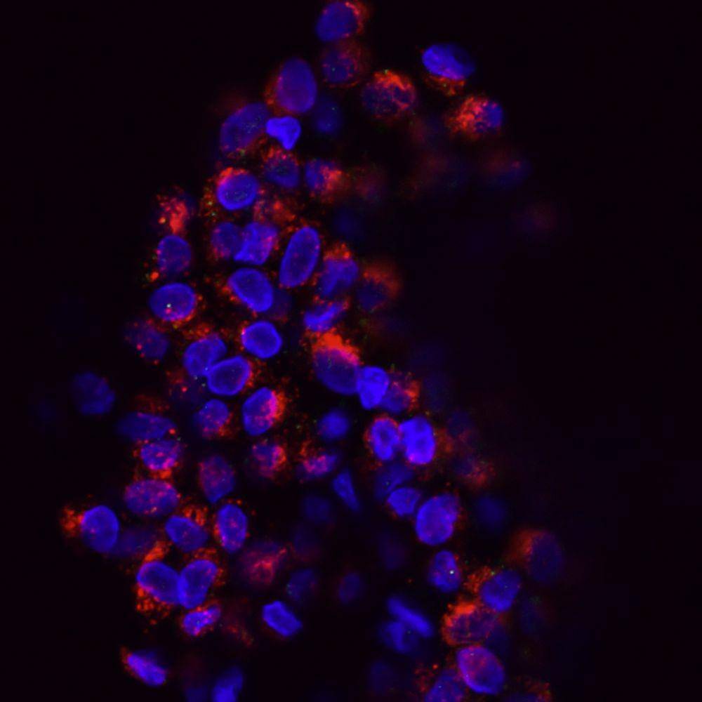 ilustrasi sel kanker (unsplash.com/National Cancer Institute)