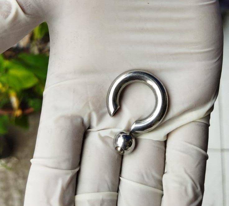 Cincin yang dipasang ke alat kelamin . IDN Times/ dok Damkar Blitar