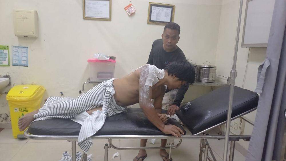Asmani mengalami luka bakar di punggung bagian kanan (IDN Times/istimewa)