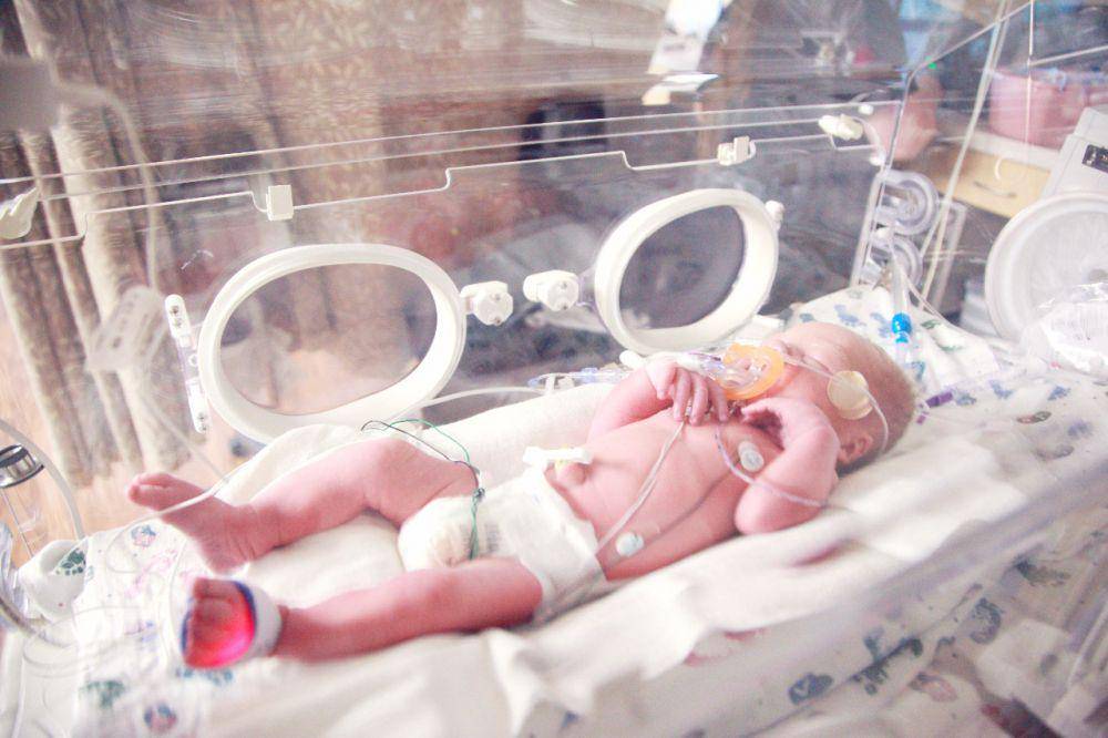 ilustrasi ventilator pada bayi prematur (unsplash.com/Sharon McCutcheon)