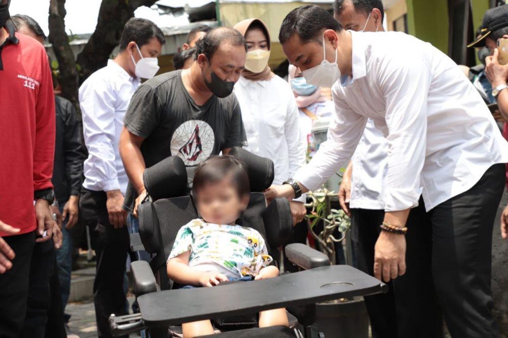 Kakak Beradik Penderita Hidrosefalus Dapat Pengobatan Gratis