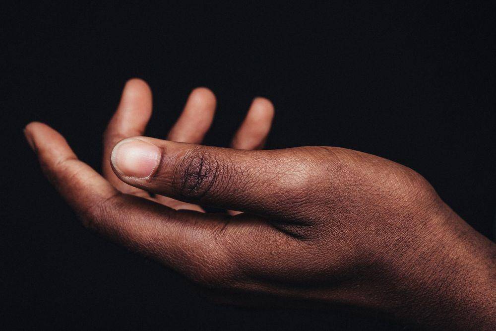 ilustrasi penyakit Buerger (unsplash.com/Nsey Benajah)