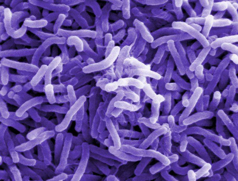 Bakteri Vibrio cholerae. (flickr.com/Vaccines at Sanofi)