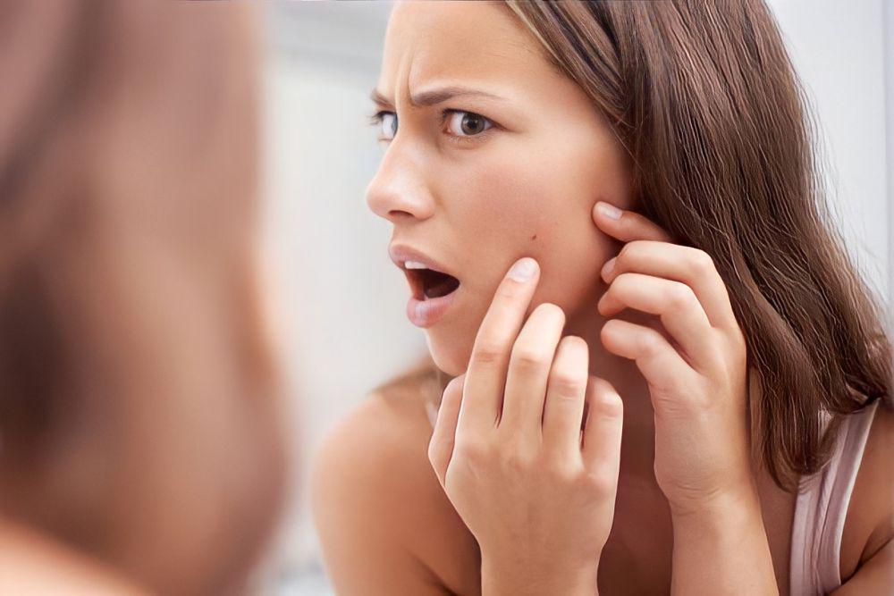 9 Kesalahan Penggunaan Skincare Ini Bisa Bikin Kamu Berjerawat