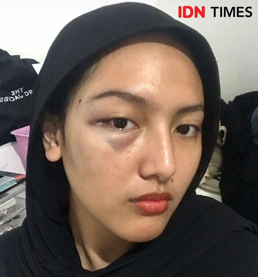 Rumahnya Dibobol Orang Mabuk di Garut, Ini Kesaksian Rifda