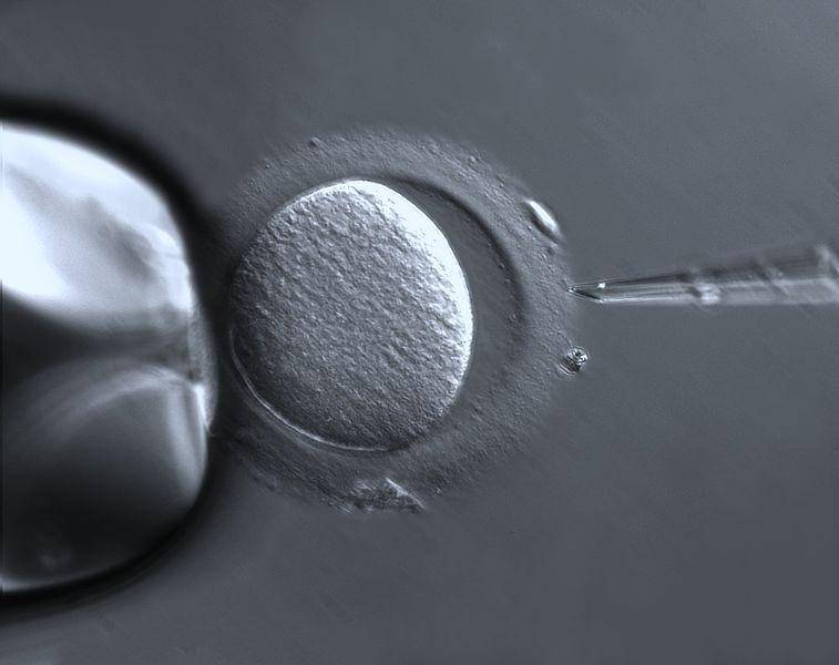 ilustrasi prosedur IVF atau bayi tabung (commons.wikimedia.org/ZEISS Microscopy)