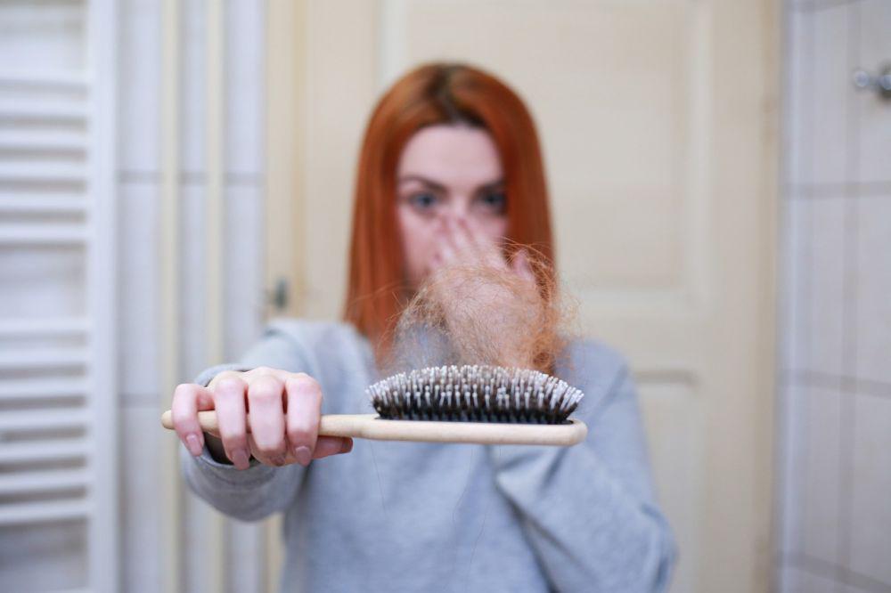 Jenis Alopecia dan Cara Mengatasinya, yuk Cegah Sejak Awal!