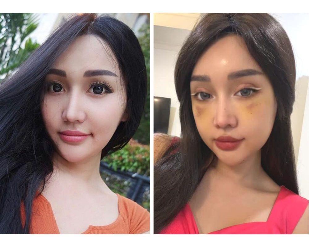 10 Potret Lucinta Luna Sebelum Vs Sesudah Operasi 'Ganti Kepala'