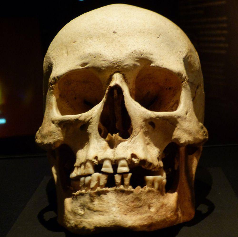 tengkorak Viking dengan ukiran gigi dari Fjälkinge (Swedia) (commons.wikimedia.org/Wolfgang Sauber)