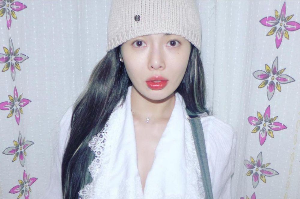 7 Idol KPop Cewek yang Pernah Mengalami Gangguan Panik