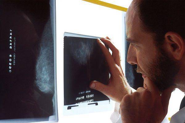 ilustrasi dokter mengamati X-ray (unsplash.com/National Cancer Institute)