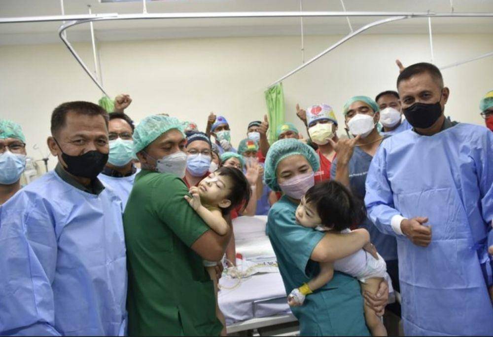 Tim dari RSUP Prof Kandou Manado, Sulawesi Utara berhasil memisahkan anak kembar siam, Jovana dan Jovalin pada 21 April 2022 (Dokumentasi Dispen TNI AD)