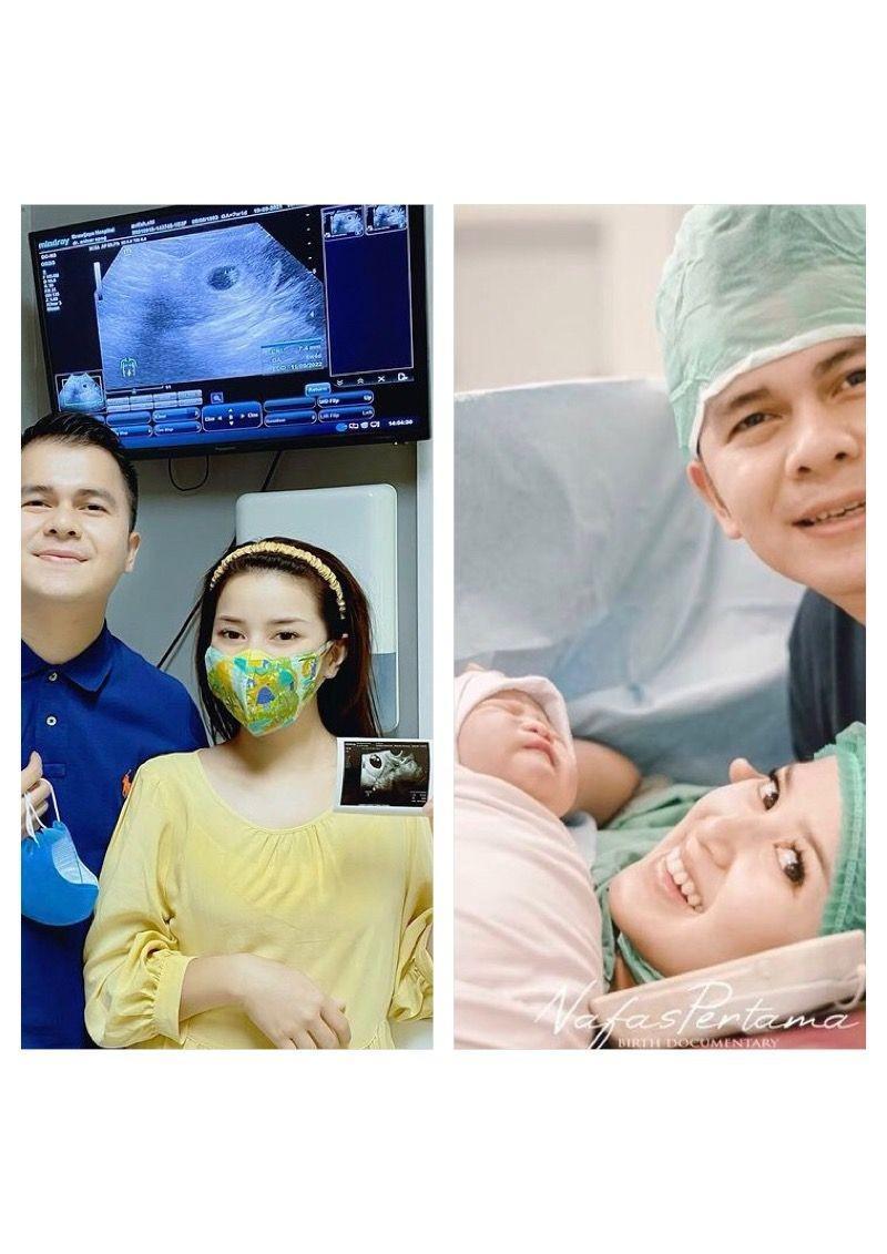 10 Perjuangan Rosiana Dewi dari Hamil Hingga Lahiran Anak Pertama