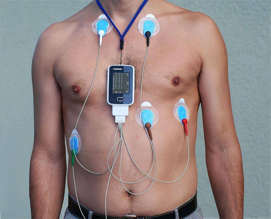 ilustrasi monitor Holter (commons.wikimedia.org/Misscurry)