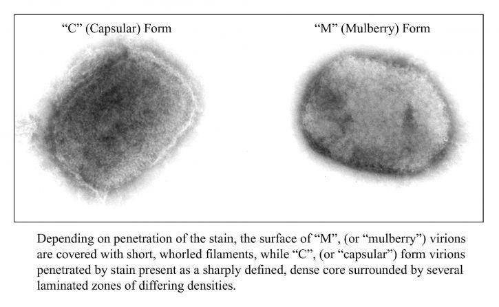 ilustrasi virus monkeypox (pixnio.com/Cynthia S. Goldsmith, Inger K. Damon, Sherif R. Zaki, USCDCP)