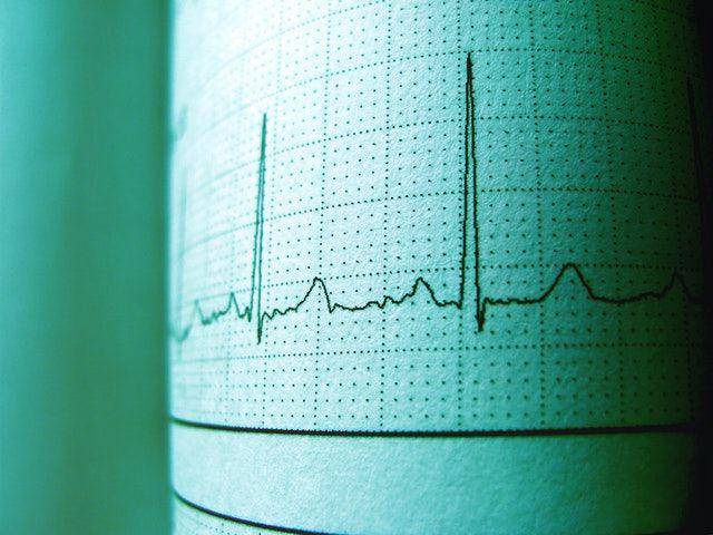 ilustrasi denyut jantung manusia, EKG (pexels.com/Luan Rezende)