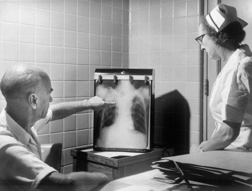 ilustrasi x-ray pasien TBC (unsplash.com/CDC)