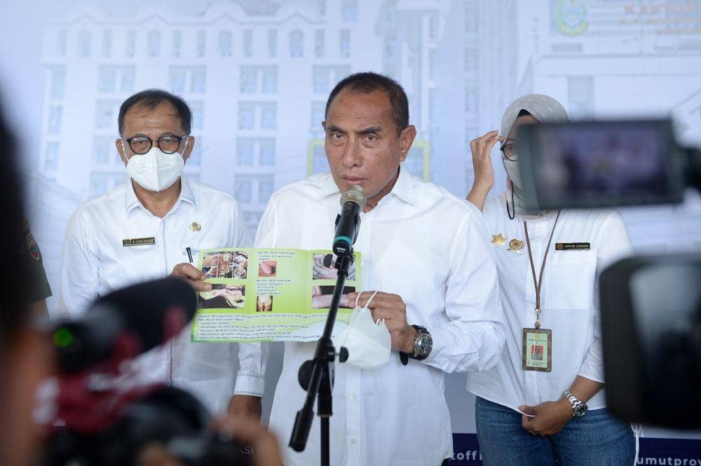 Gubernur Sumatera Utara (Sumut) Edy Rahmayadi menyampaikan keterangan pers, usai memimpin Rapat Koordinasi yang diikuti oleh unsur Forkopimda Sumut dan Instansi terkait tentang Pengendalian Penyakit Mulut dan Kuku pada Ternak di Aula Tengku Rizal Nurdin Jalan Jenderal Sudirman Nomor 41 Medan. (Istimewa/IDN Times)