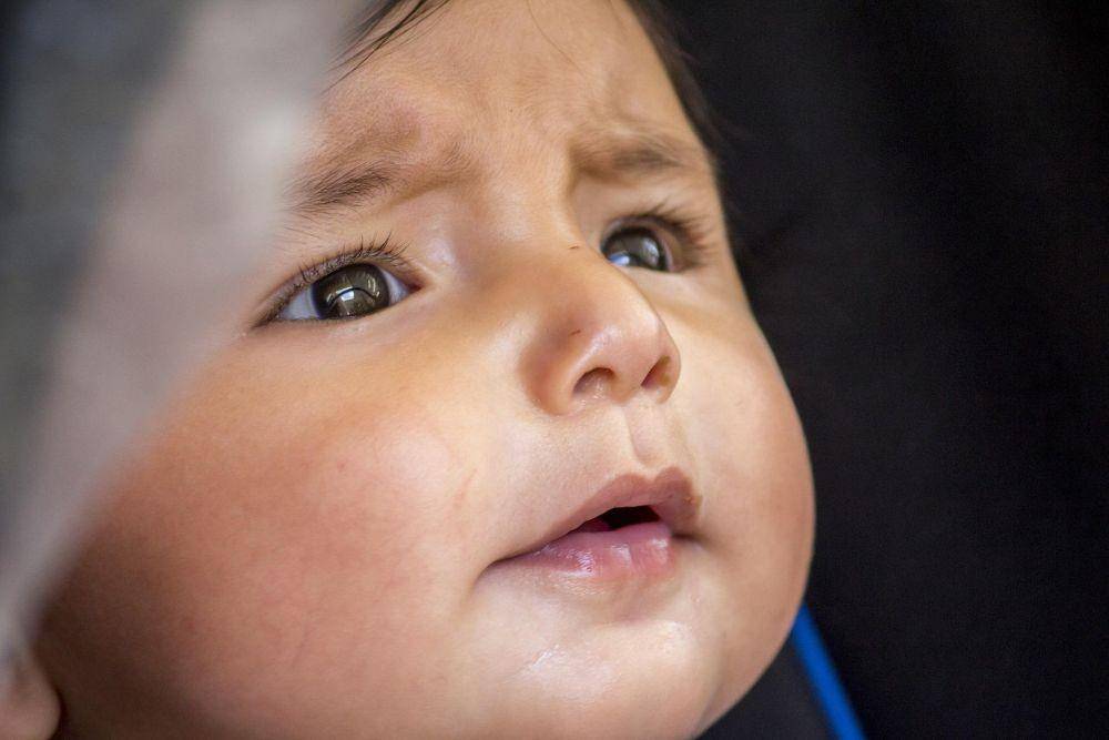 ilustrasi hidung anak-anak (pixabay.com/darkside-550)