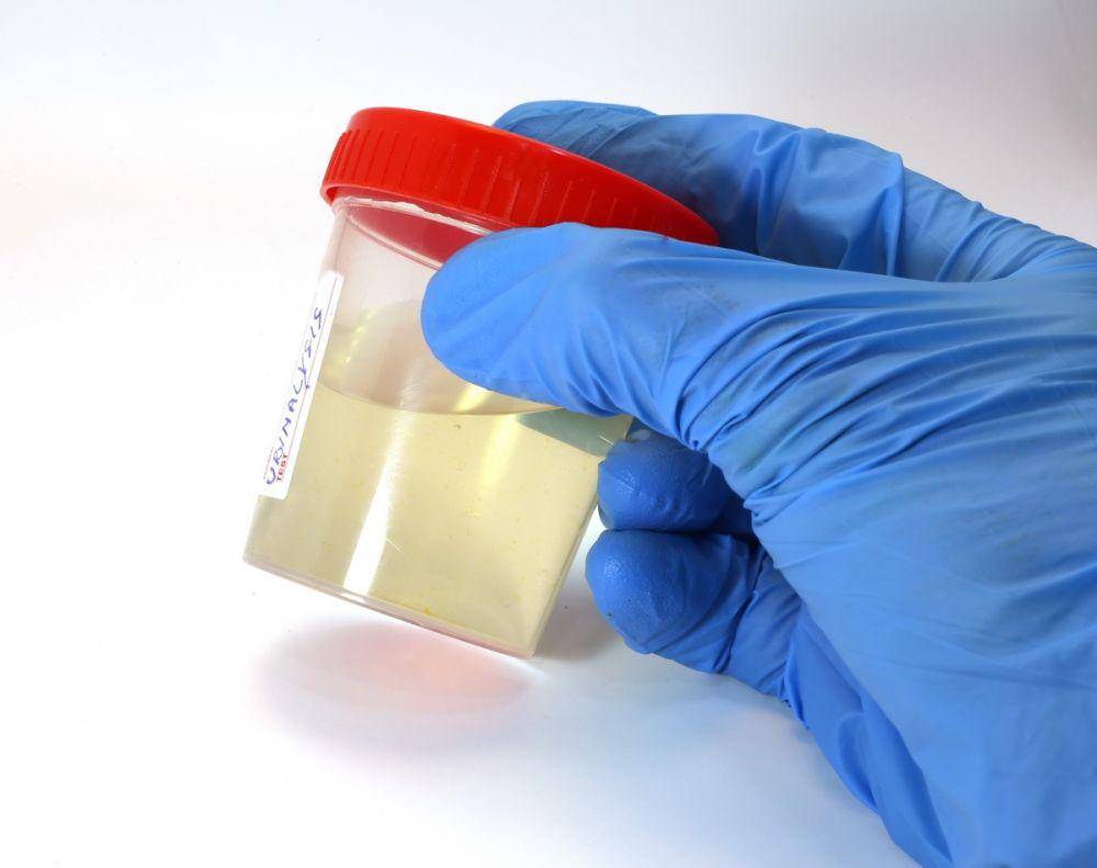 ilustrasi pemeriksaan sampel urine (commons.wikimedia.org/Federico Candoni)