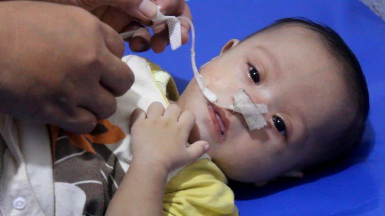 Butuh Uluran Tangan Dermawan, Bayi Usia 5 Bulan Alami Jantung Bocor