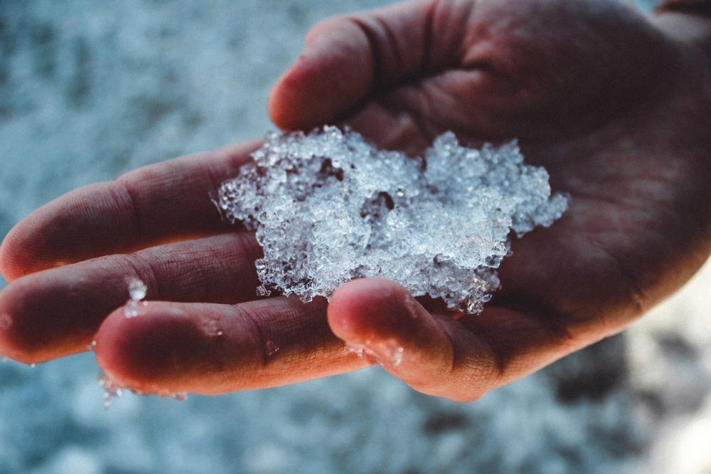 Ice Burn: Penyebab, Gejala, dan Penanganan