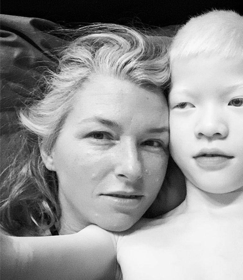 Stephanie Sinclair dan bocah albino (instagram.com/stephsinclairpix)