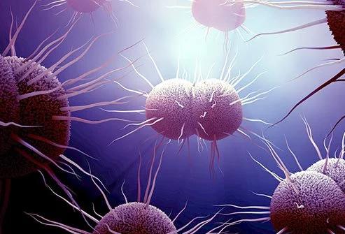 Kencing Nanah Super 'Super Gonorrhea' Hebohkan Publik, Apa Itu?