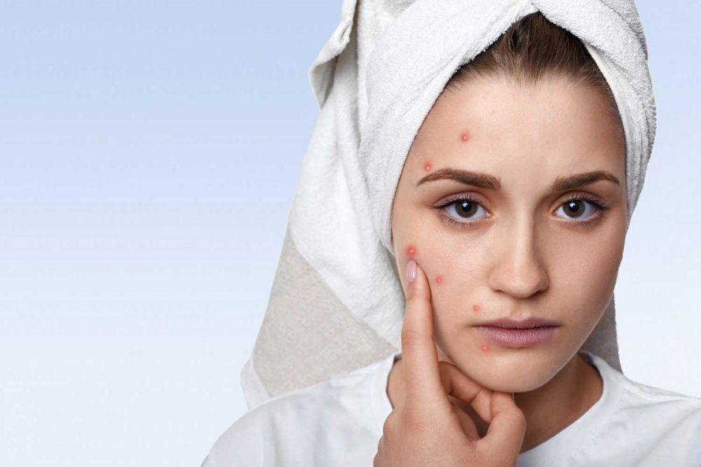 5 Rekomendasi Face Wash Murah, Ampuh Atasi Masalah Jerawat