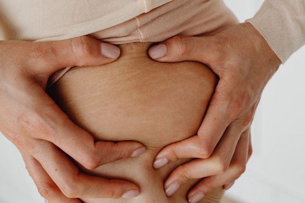 Tips Mencegah Stretch Mark, Praktikkan Mulai Hari Ini