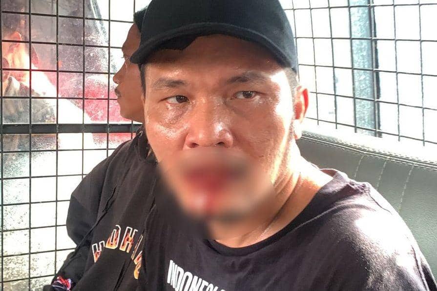 Seorang massa mengalami pendarahan di bagian mulut. (Istimewa)