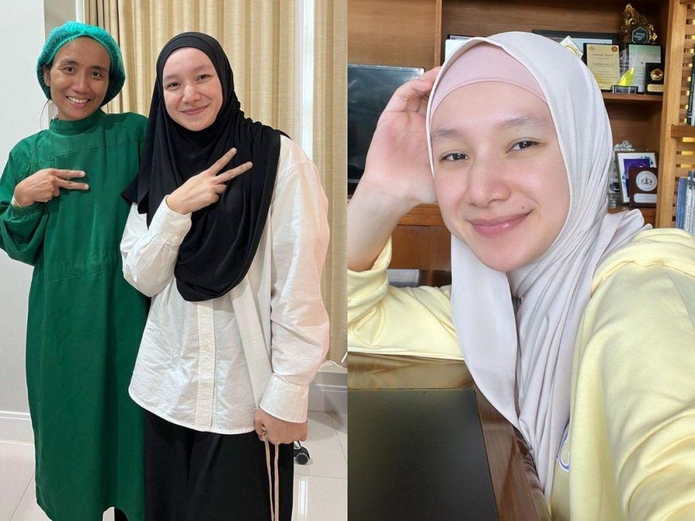 9 Potret Bare Face Indri Giana, Mengaku Malas Makep Selama Hamil