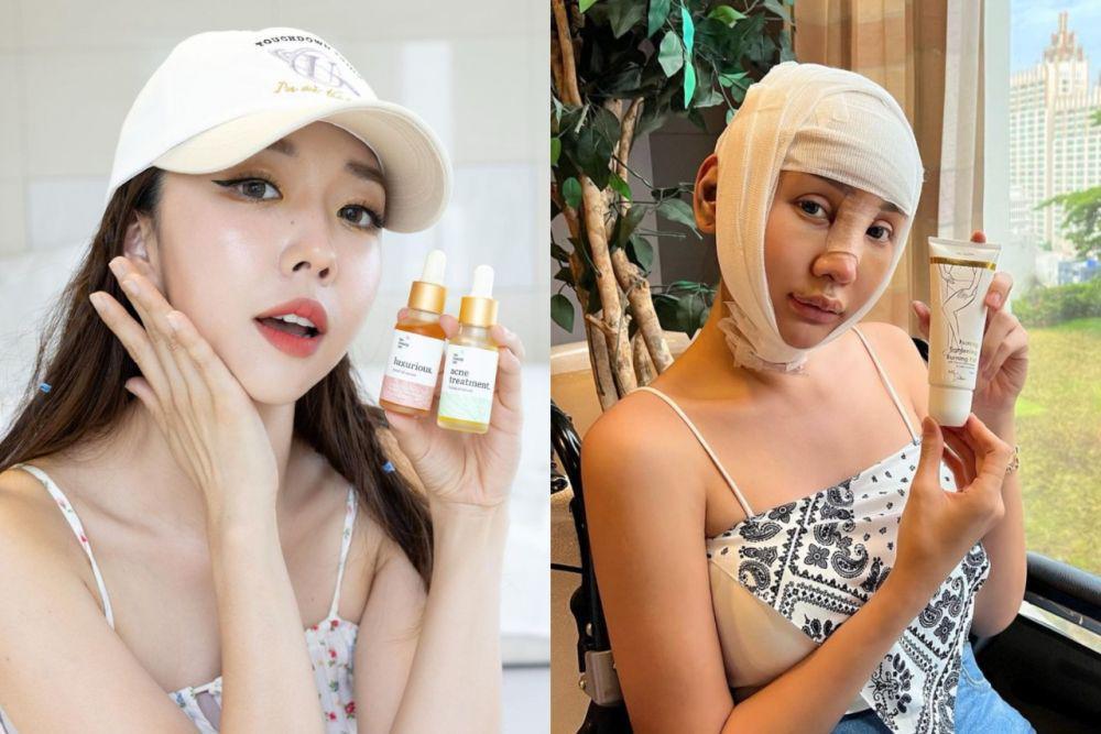 5 YouTuber yang Sajikan Vlog Operasi Plastik, Ada Lucinta Luna