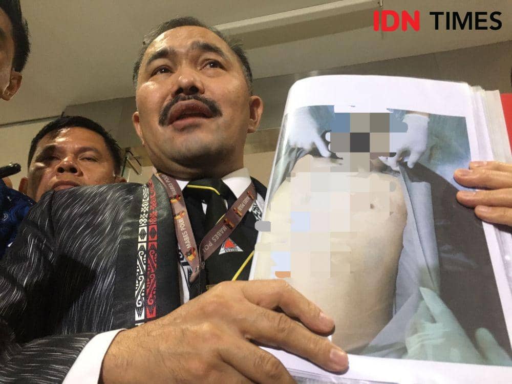 Pengacara Keluarga Brigadir J Bakal Tolak Hasil Autopsi Polisi