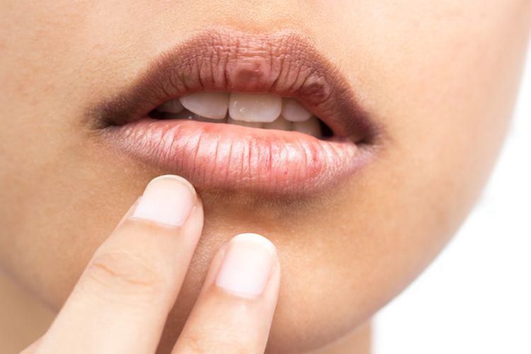 10 Rekomendasi Lipstik Bagi yang Punya Bibir Hitam dan Kering