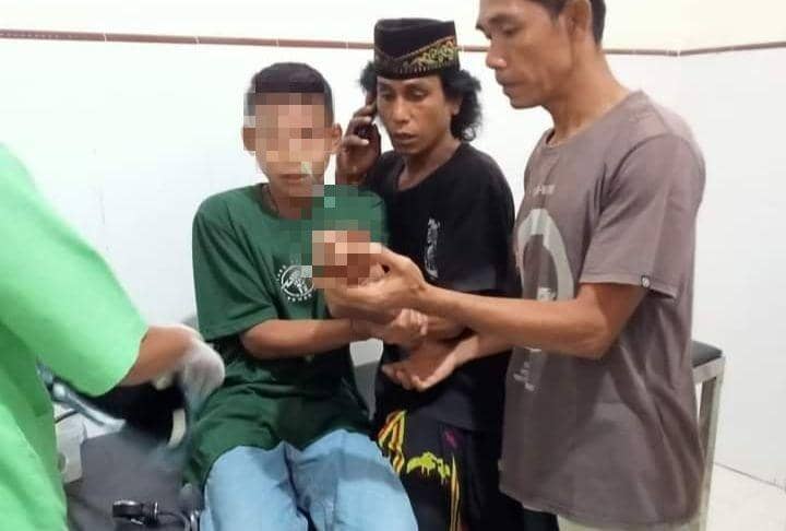 Seorang Pelajar Kena Teror Anak Panah di Bima, Warga Tutup Jalan