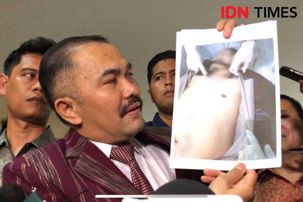 Ini Tahapan Autopsi Ulang Jenazah Brigadir J, Luka Luar-Dalam Dicek