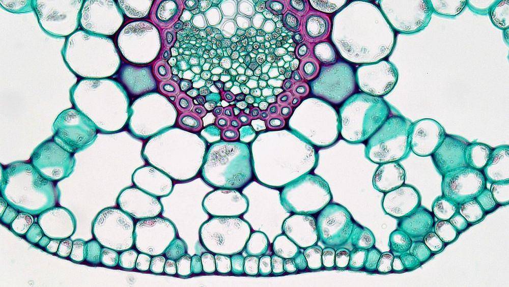 Ilustrasi jaringan pada daun yang diamati di bawah mikroskop (commons.wikimedia.org/Berkshire Community College Bioscience Image Library)