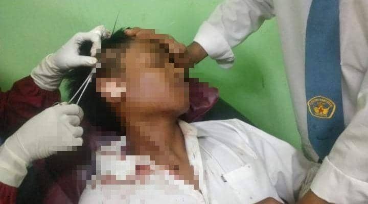 Seorang Siswa di Bima Dikeroyok Gegara Saling Caci Maki Melalui WA
