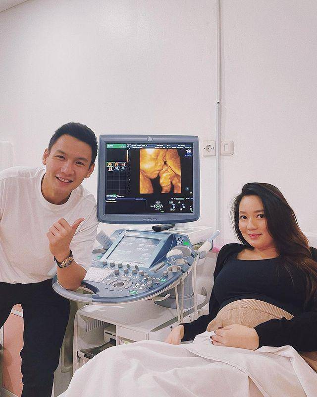 Fendy Chow dan Stella Cornelia (instagram.com/fendychow)