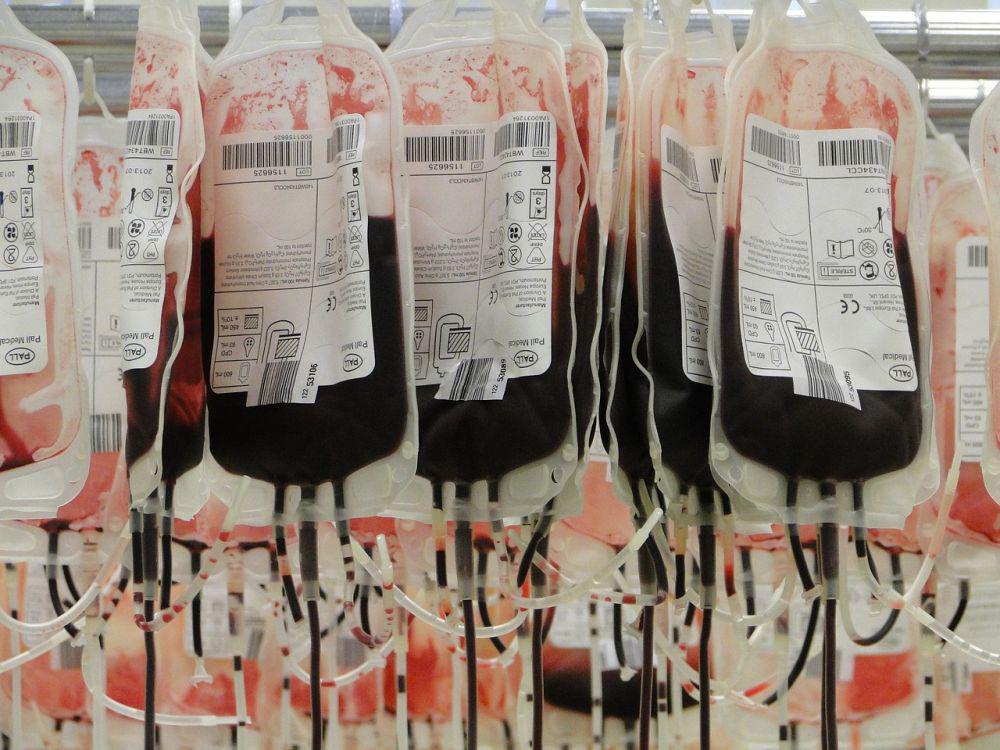 Korban Transfusi Darah Terkontaminasi HIV di Inggris Tagih Kerugian