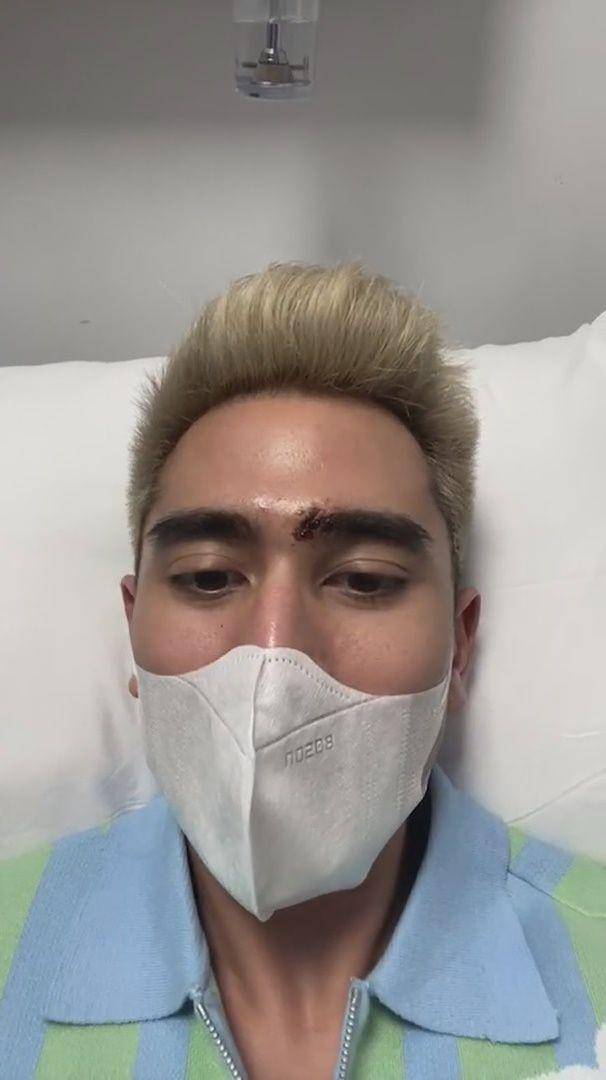Verrell Bramasta alami 20 jahitan (instagram.com/bramastavrl)