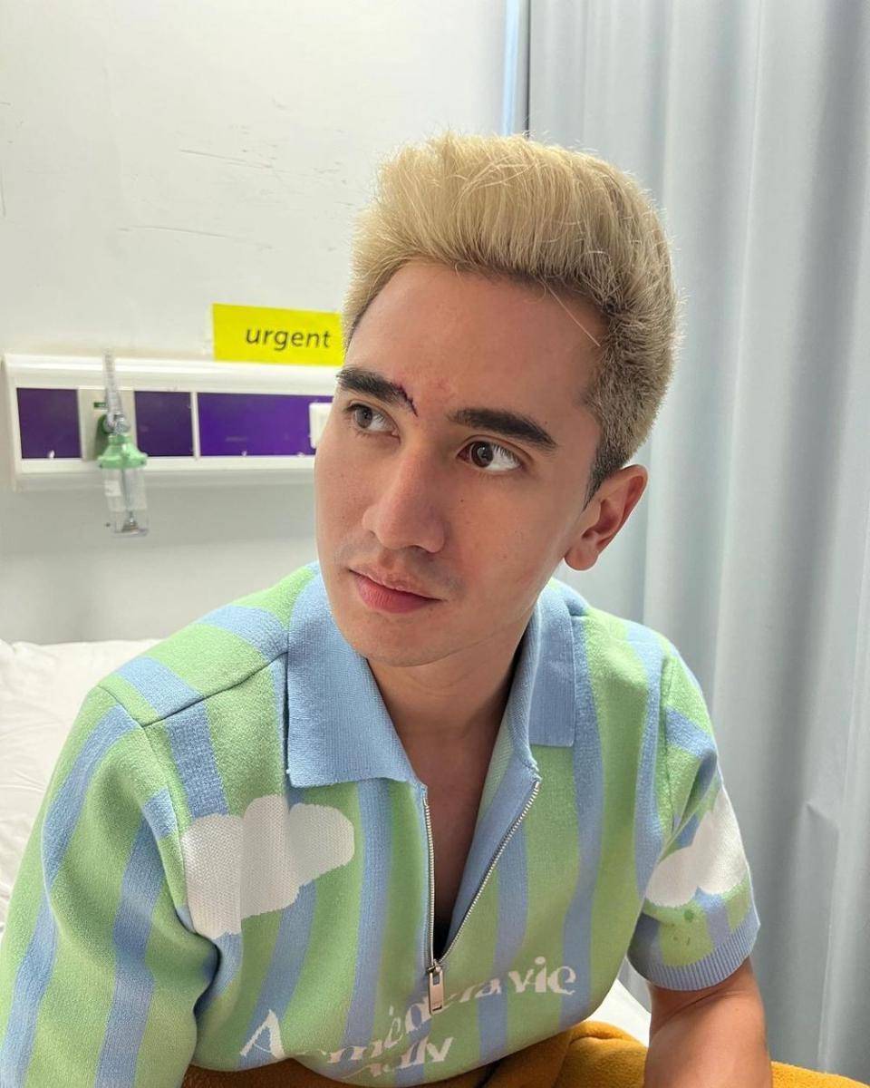 Verrell Bramasta alami 20 jahitan (instagram.com/bramastavrl)
