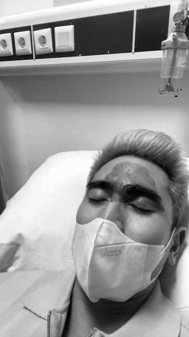 Verrell Bramasta alami 20 jahitan (instagram.com/bramastavrl)