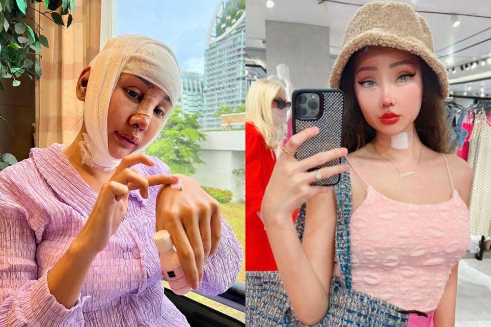 Alasan Lucinta Luna Diduga Tidak Operasi Plastik di Korea Selatan