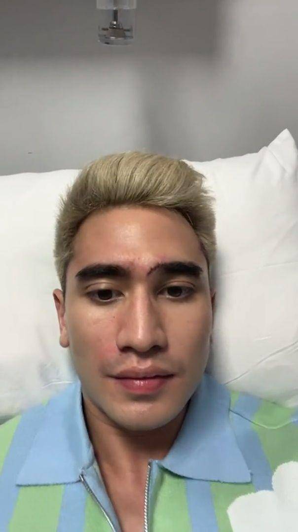 Verrell Bramasta alami 20 jahitan (instagram.com/bramastavrl)